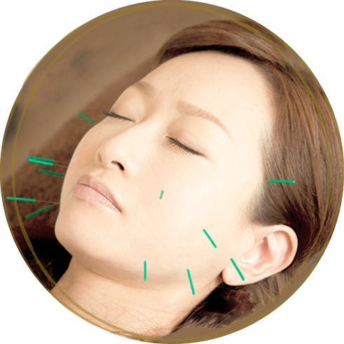 美顔鍼(美容鍼)